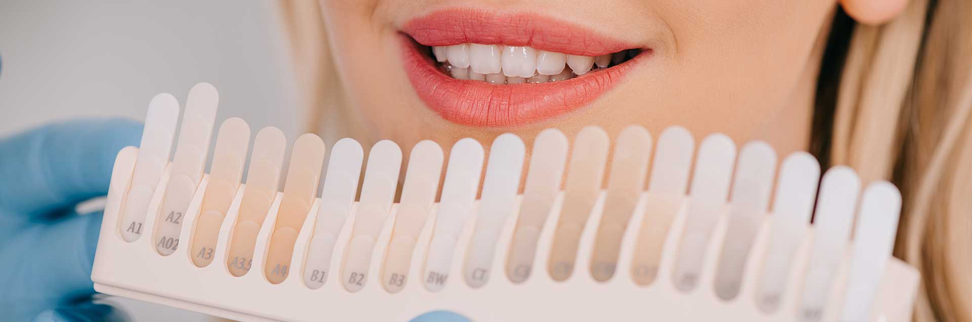 Cropped view of male dentist matching teeth color of woman with palette in clinic, teeth whitening concept