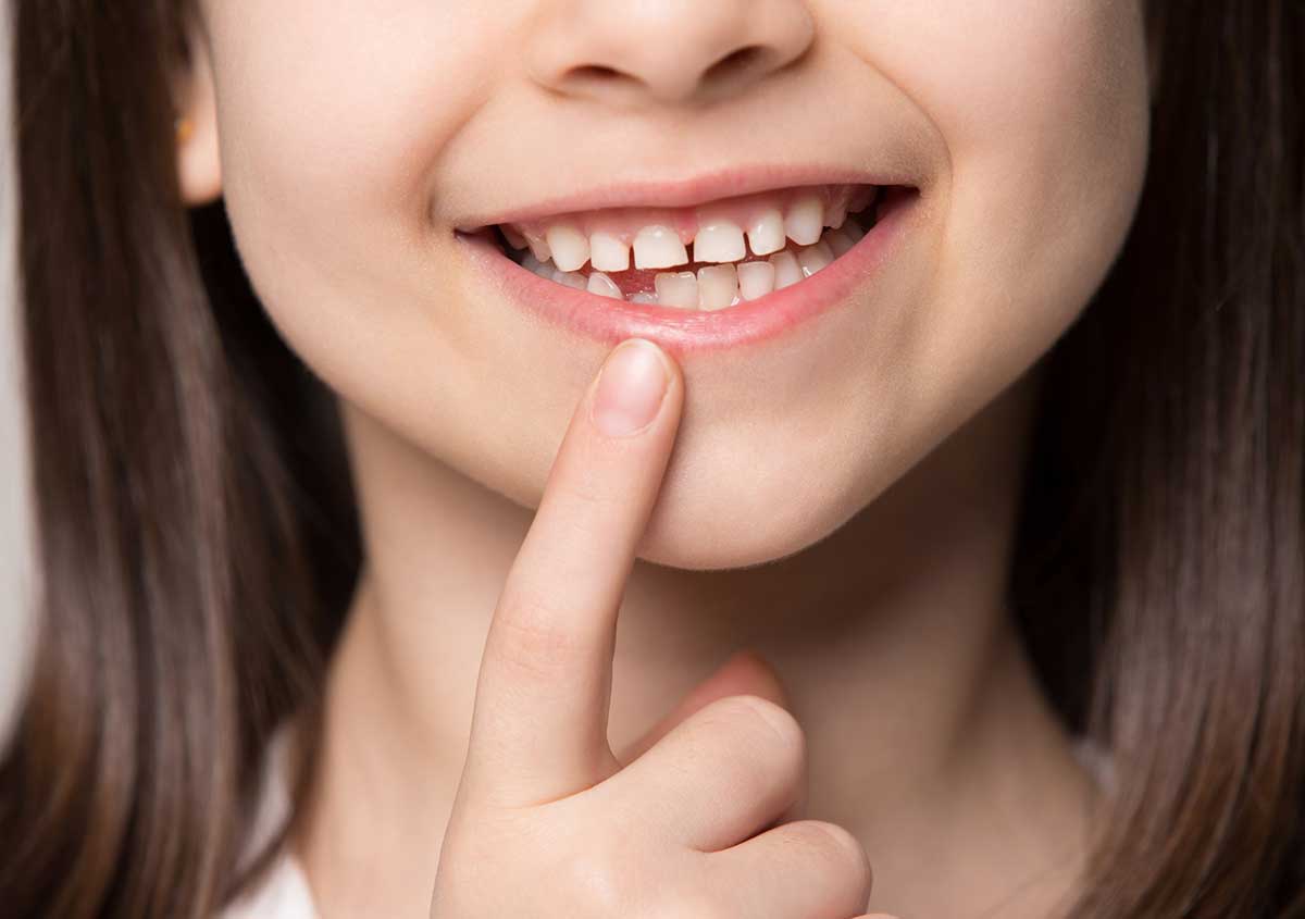 Close up little preschool girl showing growing first permanent molar