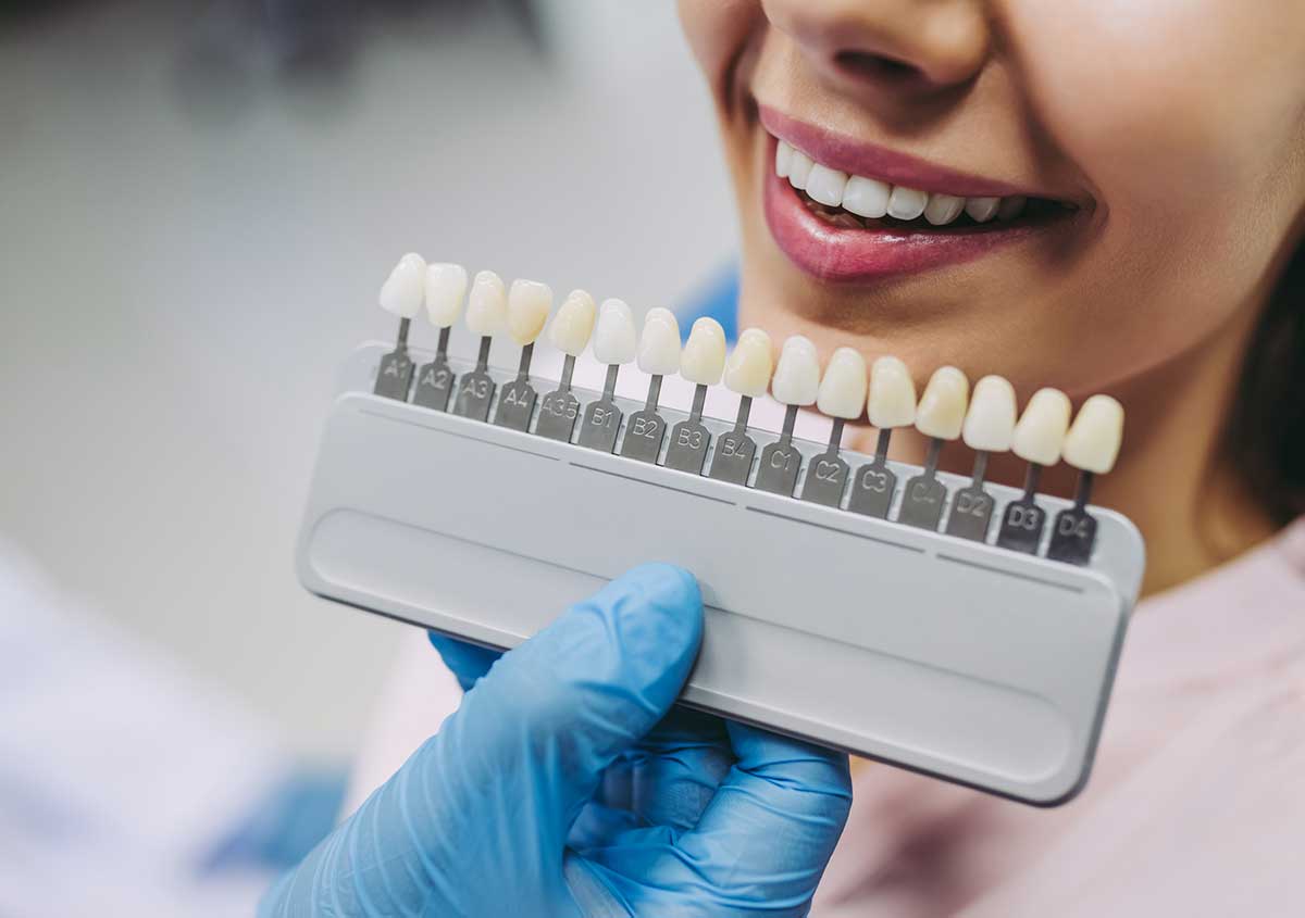 What Are Veneers And What Are The Options?